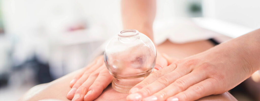 Effective Cupping Therapy Techniques