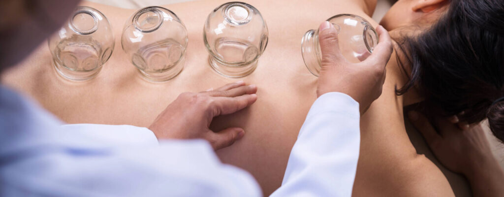Find Neck Pain Relief with Cupping: A Physical Therapist’s Approach
