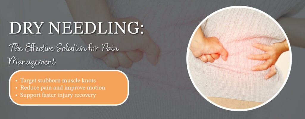 Dry Needling: The Effective Solution for Pain Management