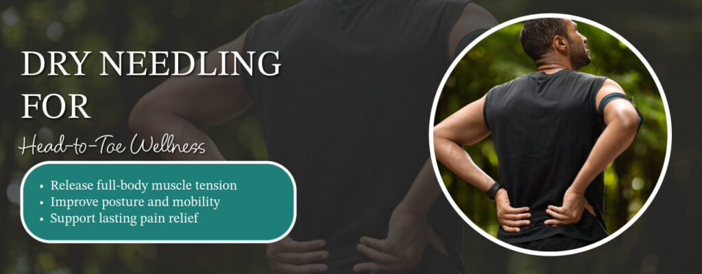 Dry Needling for Head-to-Toe Wellness